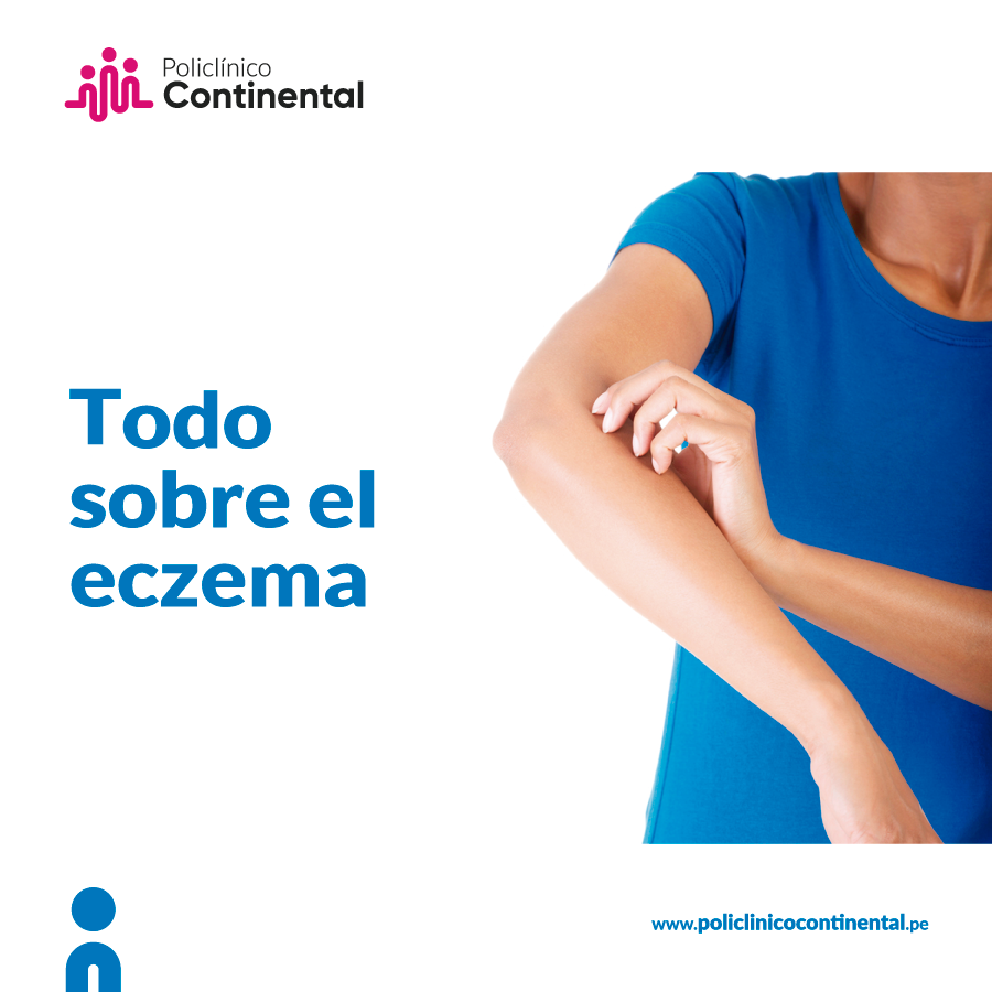 Eczema, consejos para su tratamiento Policlínico Continental